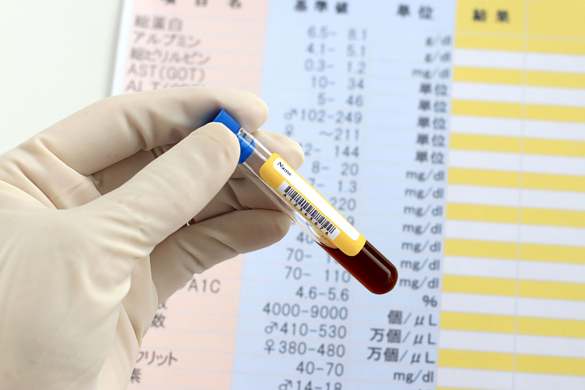 板橋区の血液内科でスクリーニング検査のための採血を行う様子
